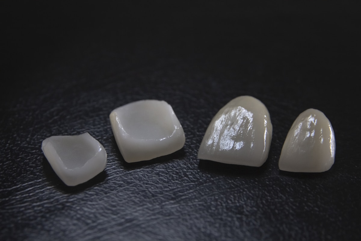 Porcelain veneers